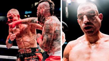 Luchador sufre inflamación facial severa y pelea es detenida en Manchester