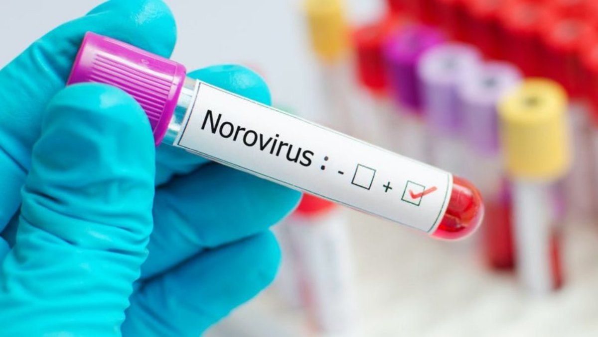 El norovirus tiene muchas similitudes con el coronavirus Covid-19 El norovirus tiene muchas similitudes con el coronavirus Covid-19