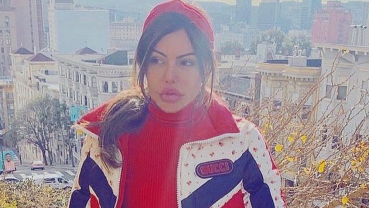 La modelo casi muere por el procedimiento.&nbsp;