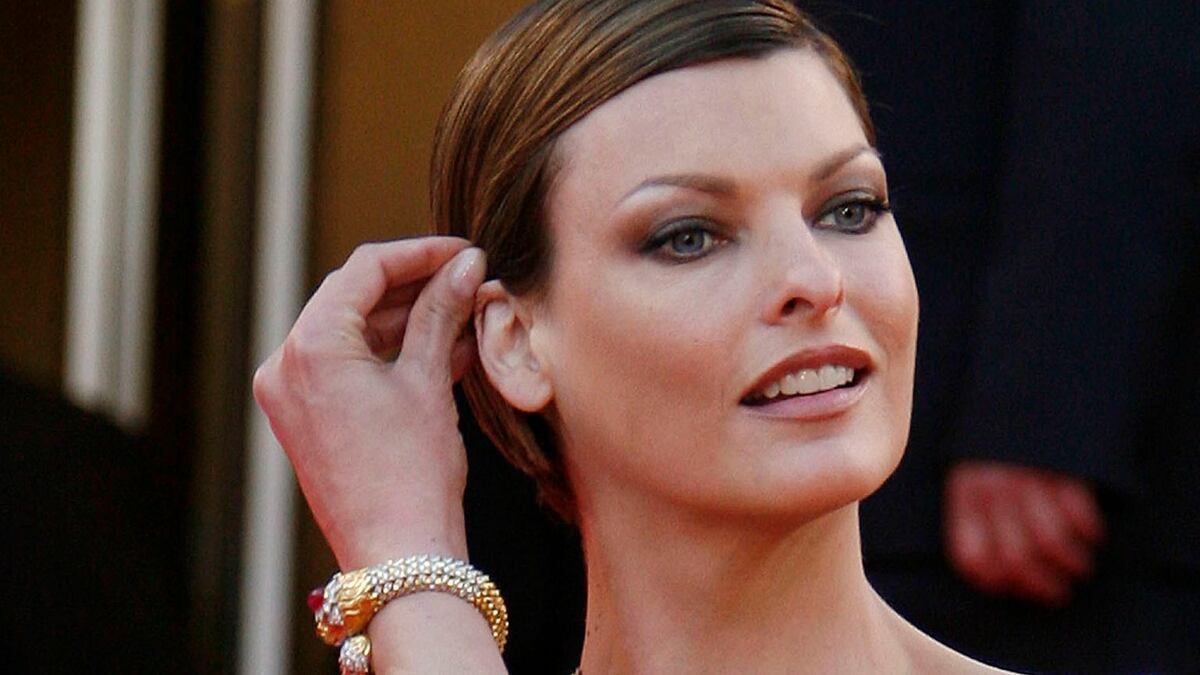 La trágica cirugía que dejó desfigurada a Linda Evangelista